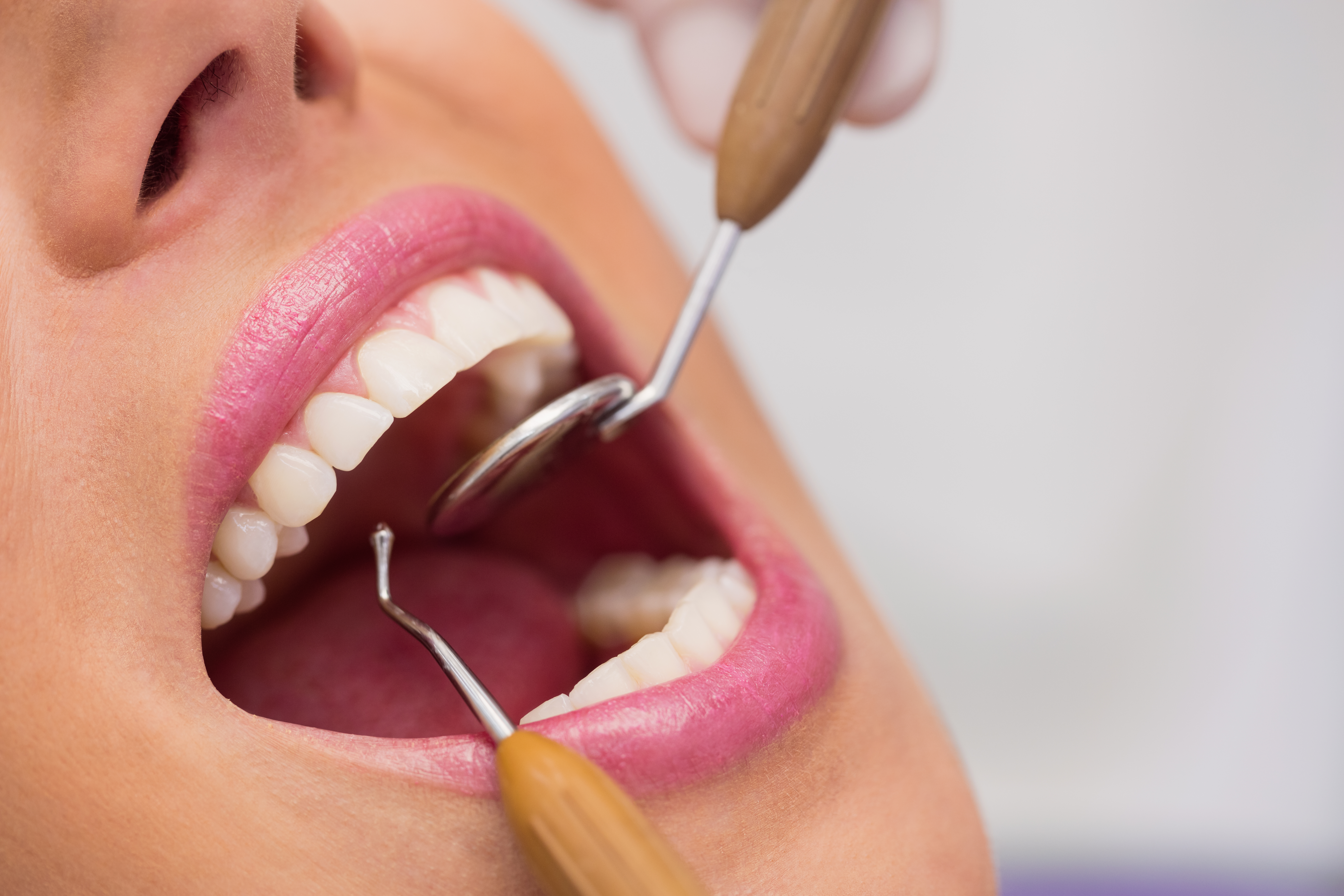 Dentalna higijena